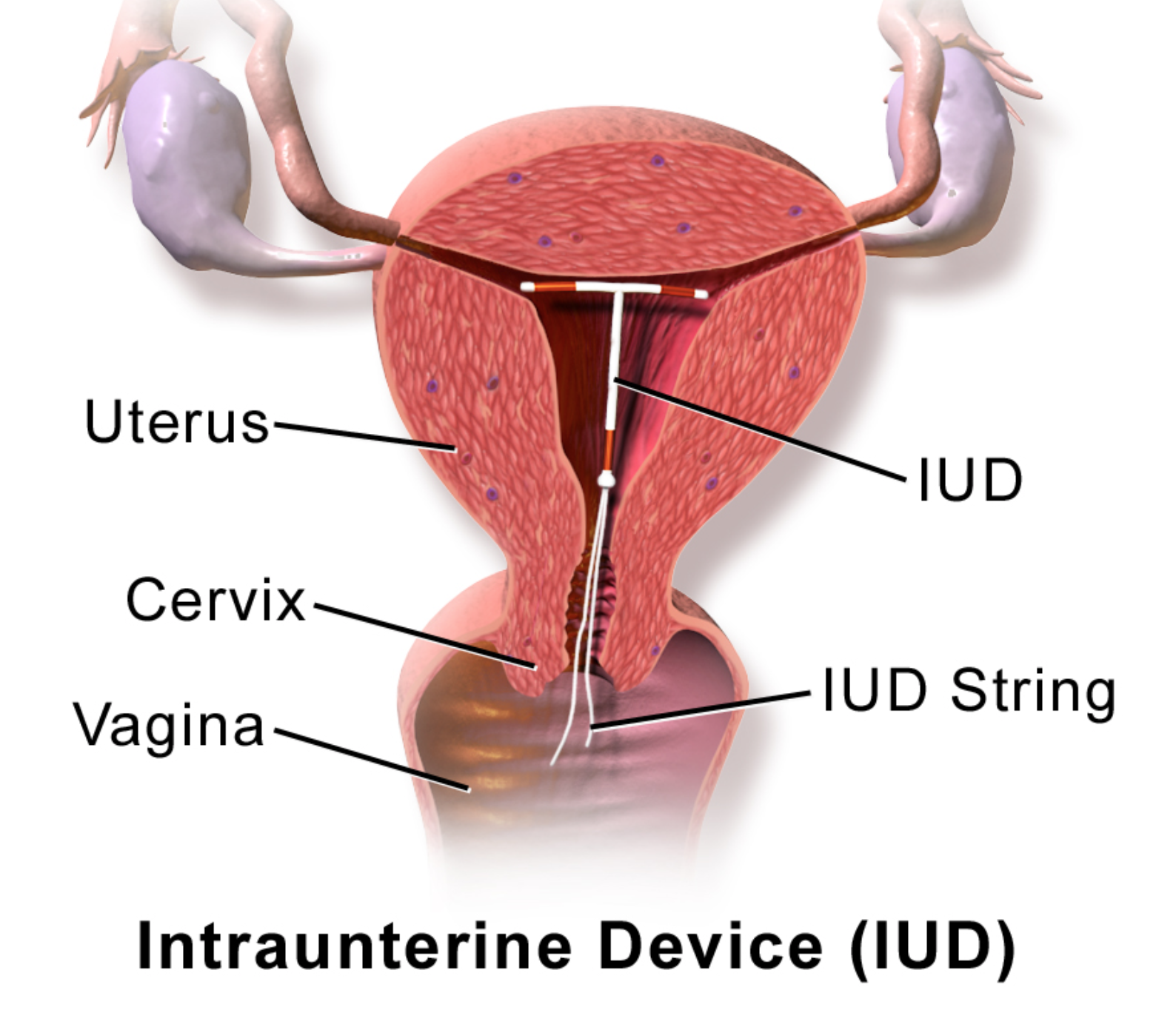 History Of Contraception Population Matters Usa 1097